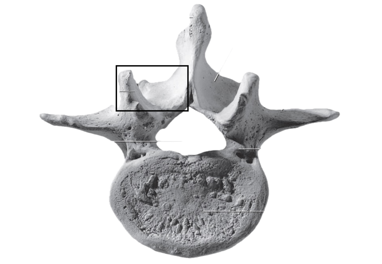 <p>Feature of the lumbar vertebrae </p>
