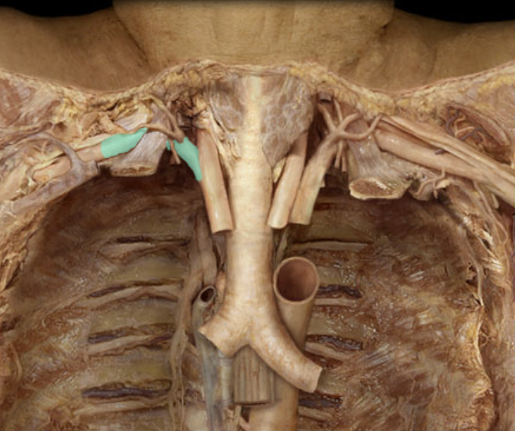 <p>Identify the feature of the arch of aorta</p>