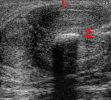 <p>Identify this image. </p>