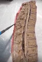 <p>Name the ligament</p>