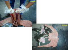 <p>Describe this pregnancy</p>