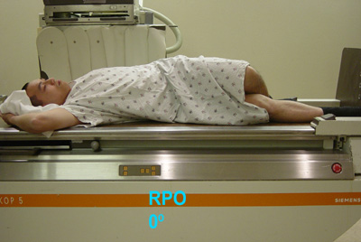<p>right posterior aspect of body closest to IR</p>