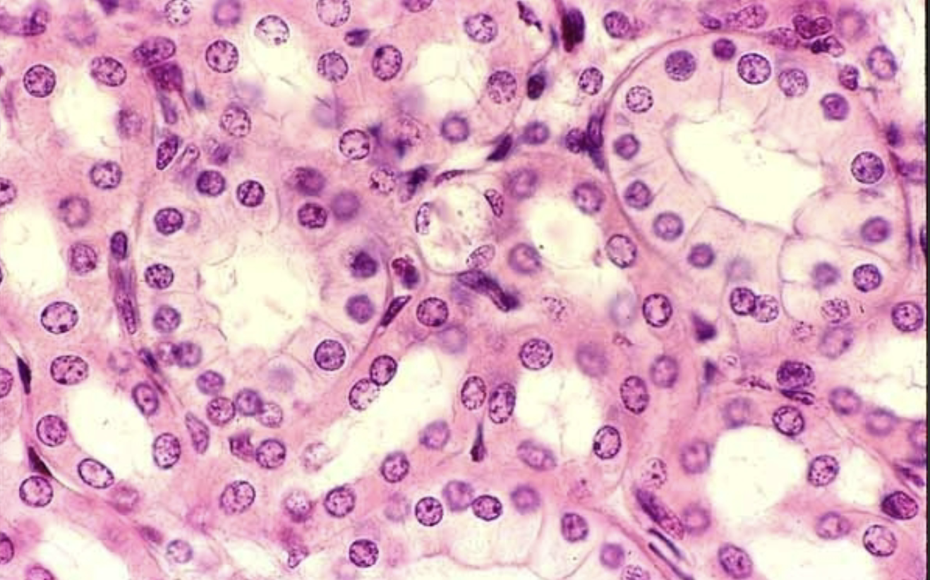 <p>Name this type of epithelium & give example </p>