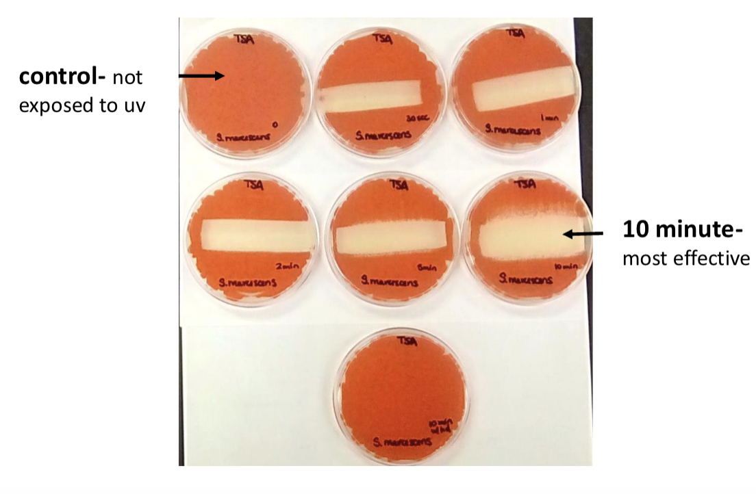<p>what bacteria is this?</p>