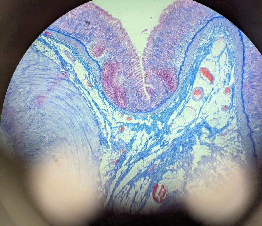 <p>Where in the body is this</p>