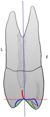 <p>Which premolar is most likely to have two roots?</p>