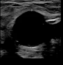 <p>is the probe longitudinal or transverse</p>