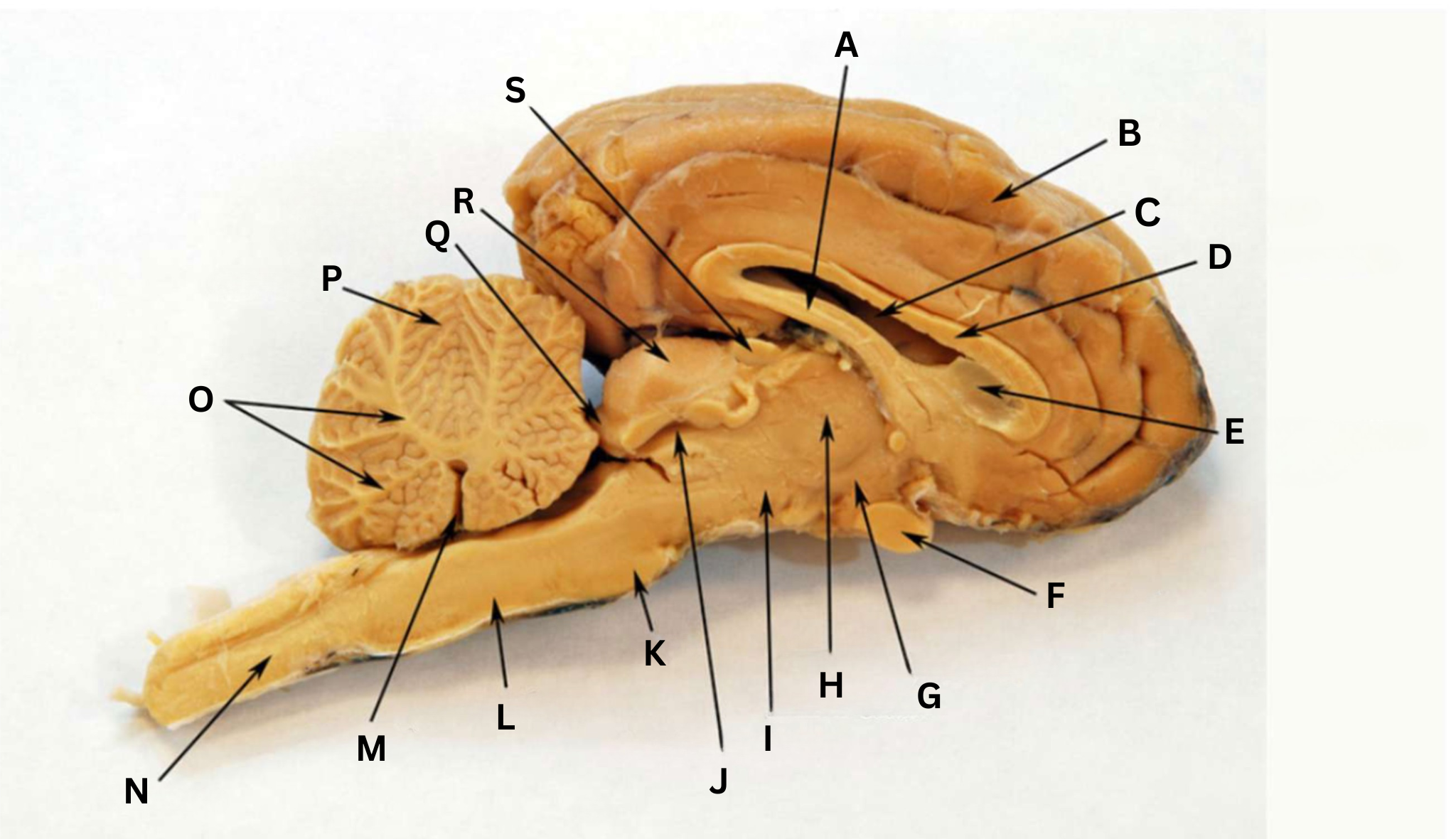 <p>Thalamus</p>