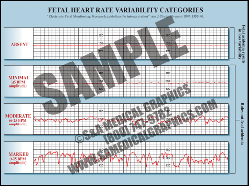 <p>What are the four categories of FHR variability and their amplitude ranges?</p>
