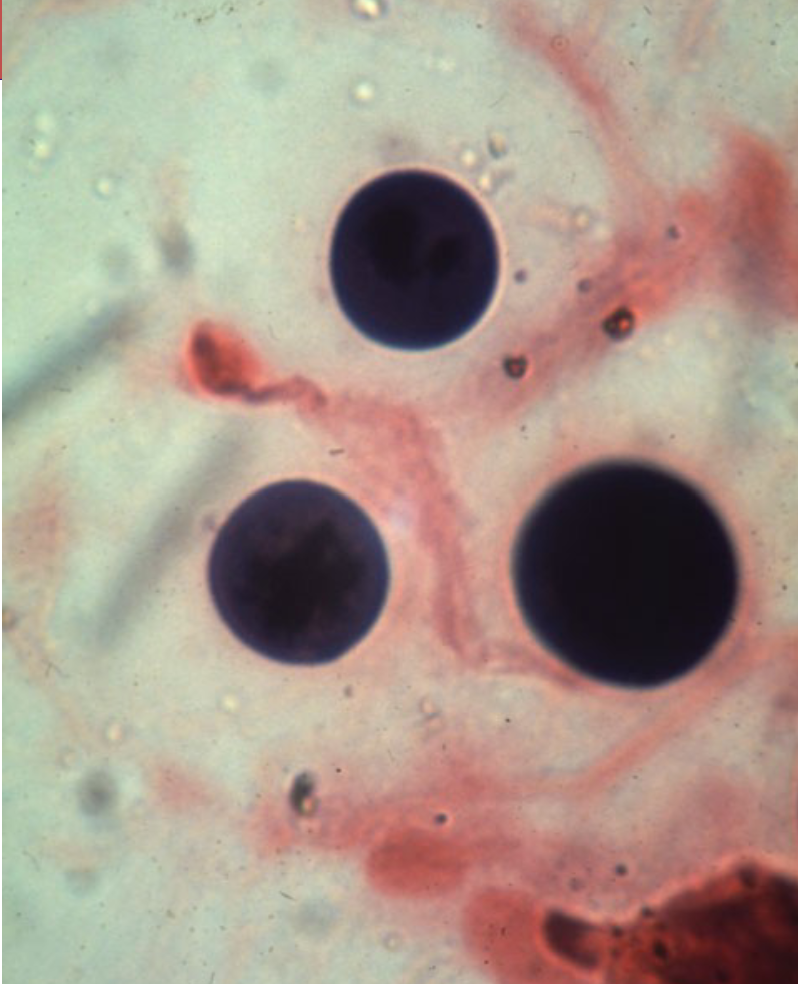 <p>Identify the Infectious Yeast</p>