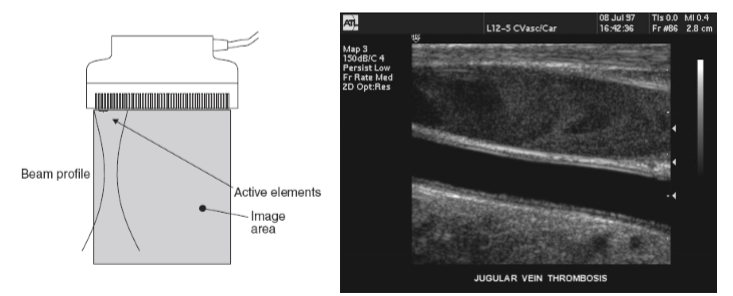 <ol><li><p>elements are in a straight line and are fired as a group</p></li><li><p>beam electronically focused</p></li><li><p>used in musculoskeletal and vascular imaging</p></li></ol><p></p>