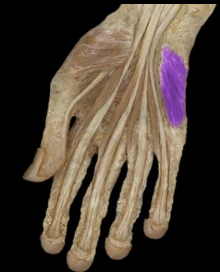 <p>What the highlighted structure is acting on the <strong><mark data-color="#28a936" style="background-color: rgb(40, 169, 54); color: inherit;">Hypothernar Group</mark>.</strong> What muscle is this called?</p>