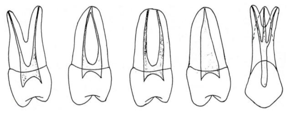 <p>What % of maxillary 1st premolars have 2 roots and 2 canals?</p>