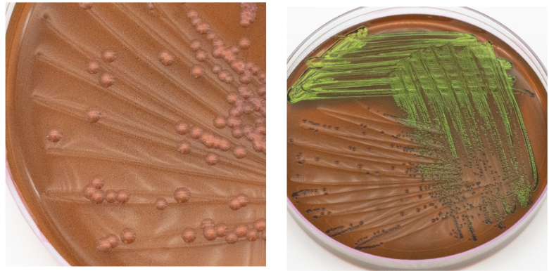 <p>EMB agar</p>