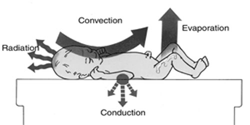 <p>Neonatal heat loss </p>