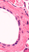 <p>What type of epithelial tissue is this?</p>