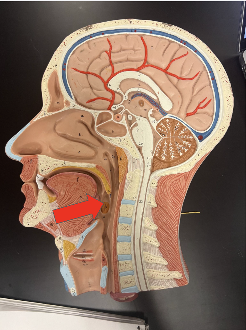 <p>This structure is the</p>