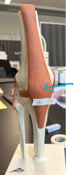 <p>ID knee joint region </p>