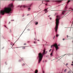 <p>name the tissue: gel-like matrix with all three fiber types; cells: fibroblasts, macrophages, mast cells, and some white blood cells</p>
