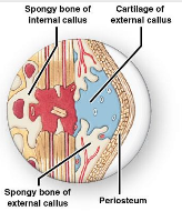 <p>Callus Formation</p>