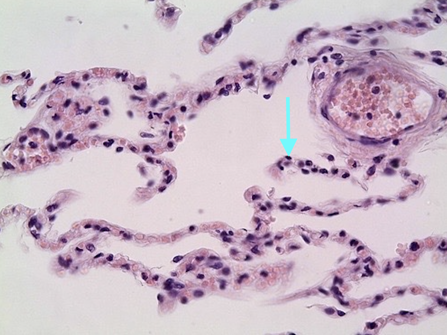 <p>Identify this tissue, structure, &amp; organ</p>