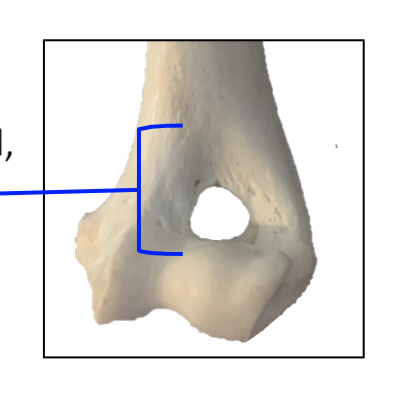 <p>A shallow, broad, or elongated basin (think bowl)</p>
