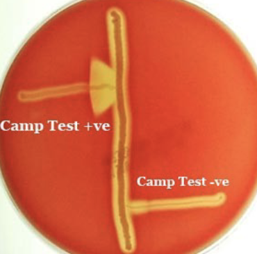 <p><u>Arrowhead (Left upper streak):</u> Group B strep (positive), the organism produces CAMP factors, zone of increased hemolysis</p><p><u>Right lower streak:</u> negative, Group A streptococci, no enhanced hemolysis</p>