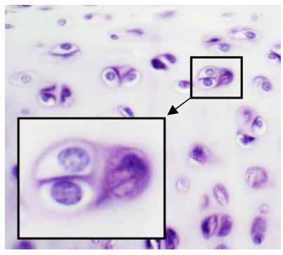 <p><strong>A19) What is the name of the region of cells that is highlighted in the box and arises during interstitial growth of cartilage?</strong></p>