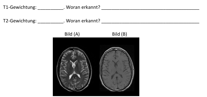 <p>Welches der nachfolgend abgebildeten axialen MR-Bilder durch das menschliche Gehirn ist T1-gewichtet, welches T2-gewichtet? Woran können Sie dies am einfachsten erkennen?</p>