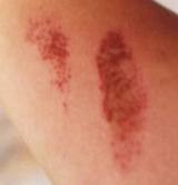 <ol><li><p>a wearing away or rubbing away by friction</p></li><li><p>a scarped or work area 3. harsh or rough in manner; irritating</p></li></ol><p></p>