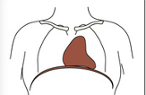<p>what kind of IR placement should we do on this body type</p>