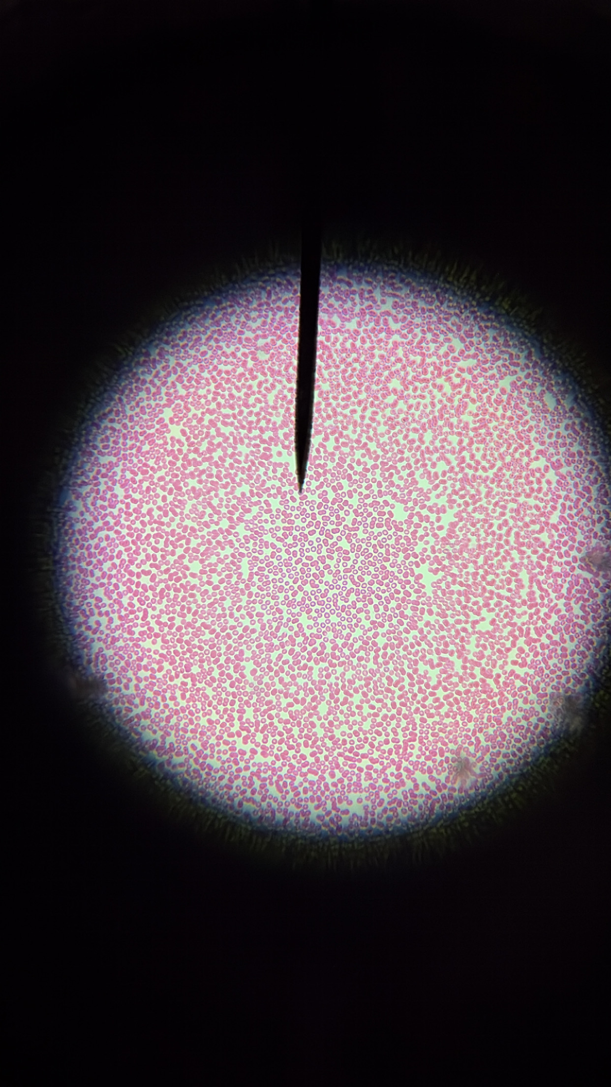 <ol><li><p>This slide shows a/an:</p></li></ol><p class="p1">a) Prokaryotic cell</p><p class="p1">b) Eukaryotic cell</p><p class="p1">c) None of the above</p><ol start="2"><li><p class="p1">Which type of cells does this slide show?</p><p class="p1">a) Cocci cells</p><p class="p1">b) Bacilli cells</p><p class="p1">c) Spirilli cells</p><p class="p1">d) None of the above</p></li></ol><ol start="3"><li><p class="p1">Which type of cell does this slide show an example of:</p></li></ol><p class="p1">a) Spirogyra</p><p class="p1">b) Volvox</p><p class="p1">c) Diatoms</p><p class="p1">d) None of the above</p><ol start="4"><li><p class="p1">Which type of cell does this slide show an example of:</p><p class="p1">a) Amoeba</p><p class="p1">b) Paramecium</p><p class="p1">c) None of the above</p></li><li><p class="p1">Which type of cell does this slide show an example of:</p><p class="p1">a) Archaebacteria or Eubacteria</p><p class="p1">b) Plantae</p><p class="p1">c) Protista</p><p class="p1">d) Fungi</p><p class="p1">e) Animalia</p></li></ol><p class="p1"></p><p class="p1"></p>