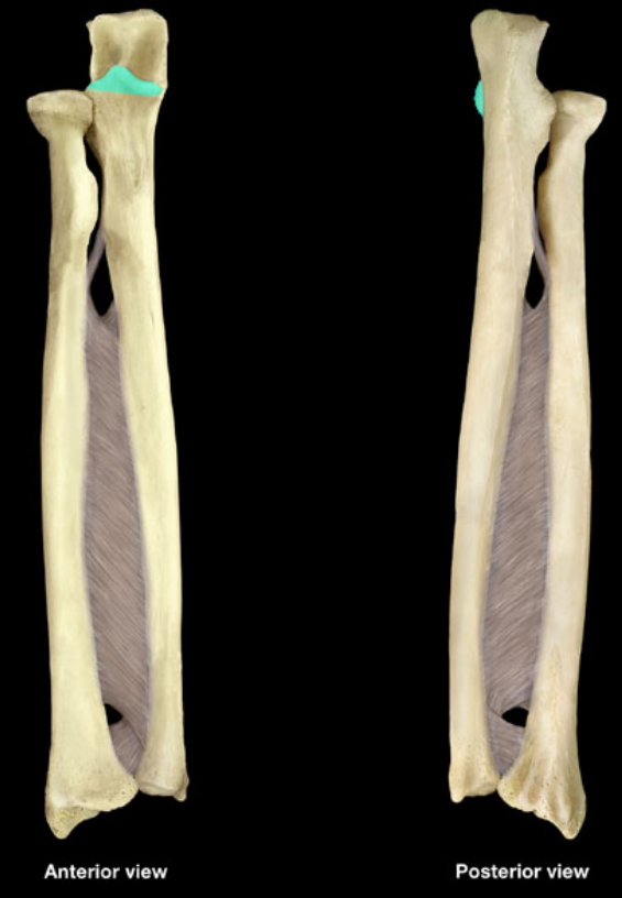 term image