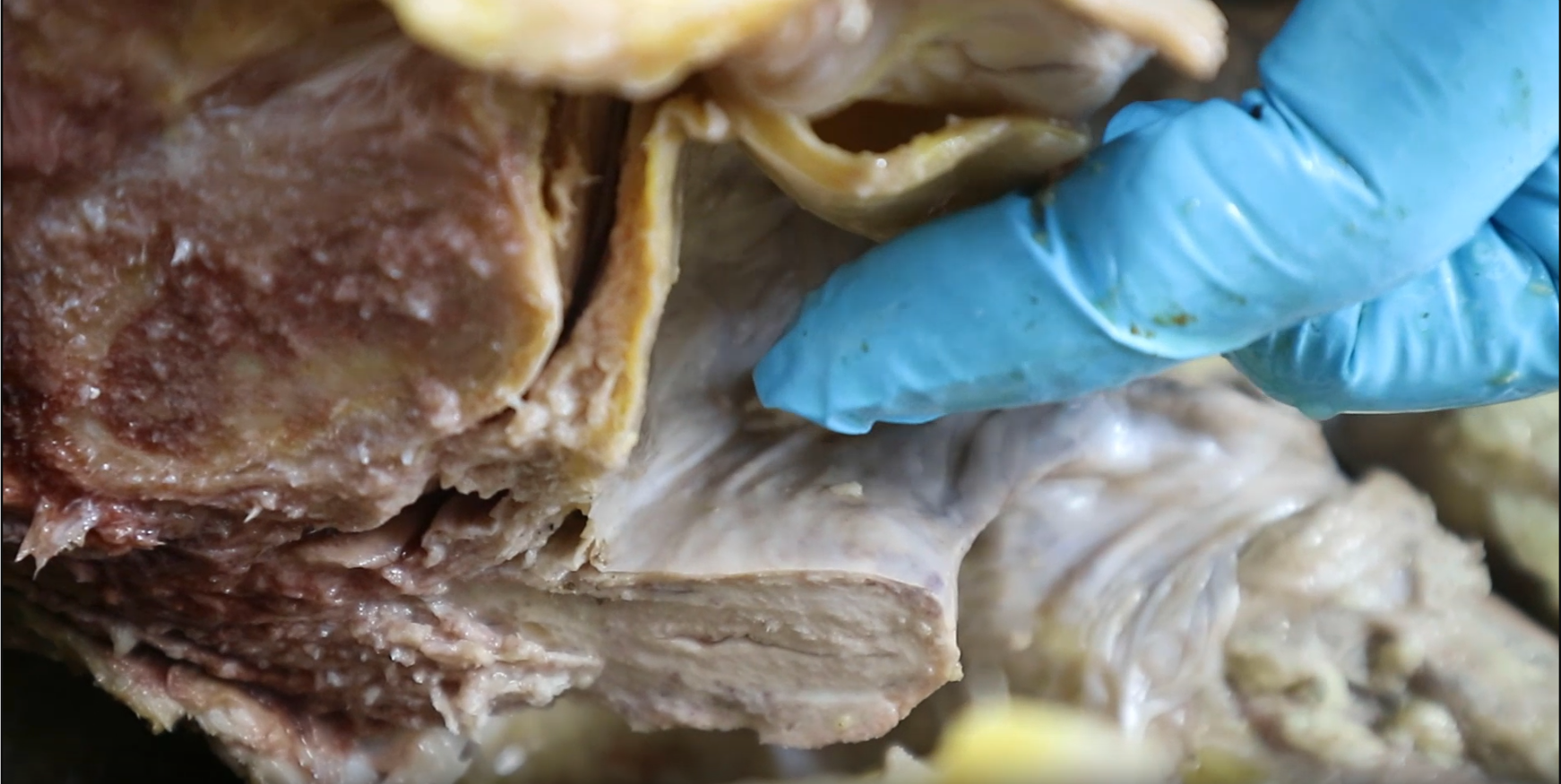 <p>space where finger is</p>