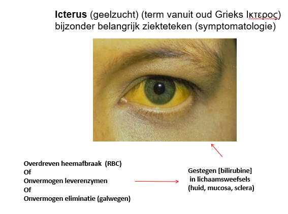 <p>icterus</p><p></p><p><span>Het wordt veroorzaakt door het onvermogen van het lichaam om heemafbraakproducten adequaat te verwijderen uit het lichaam.</span></p><p><span>—</span></p><p><span>Als we denken aan heemafbraakproducten denken we aan billirubine.</span></p><p style="text-align: left;"><span>Als het billirubine niet goed gedetoxifieerd geraakt en uit het lichaam verwijderd kan worden, stapelt het op en dan zien we dat het eerst in het sclera verschijnen en uiteindelijk ook in de huid en in de urine.</span></p><p style="text-align: left;"></p><p style="text-align: left;"><span>Dus opstapeling van heem afbraakproducten (billirubine) zien we ontstaan als er heel veel heem aangeboden wordt aan het afbraaksysteem.</span></p><p style="text-align: left;"><span>—</span></p><p style="text-align: left;"><span>Als er teveel heem geproduceerd wordt (en RBC’en gaan kapot) krijgen we veel hemoglobine dat vrijkomt in de bloedbaan en krijgen we dus heel veel heem dat in de bloedbaan snel omgezet wordt naar billirubine, maar de verdere afbraakpathway van billirubine (dus eigenlijk de billirubine conjugatie om van billirubine een meer wateroplosbare stof te maken en het zo te kunnen excreteren) is beperkt doordat er een overmaat van heem uit afbraak van RBC ontstaat</span></p><p style="text-align: left;"><span>—</span></p><p style="text-align: left;"><span>Het kan ook dat de conjugatie te traag verloopt en dat we er daarom niet in slagen om alle billirubine te conjugeren en dus te verwijderen.</span></p><p style="text-align: left;"><span>—</span></p><p style="text-align: left;"><span>Of er kan een probleem zijn met de galexcretie.</span></p><p style="text-align: left;"><span>Dus het billirubine is wel geconjugeerd geraakt en is in de gal gesecreteerd, maar de gal zelf slaagt er niet in zich bij de voedselbolus te voegen en zo het lichaam te verlaten via de stoelgang.</span></p><p><span>Dit kan bv als er een verstopping aanwezig is in de galweg (bv een steen, een tumor).</span></p><p></p><p><span>Er zijn dus verschillende situaties waarbij men icterisch&nbsp; kan worden.</span></p><p style="text-align: left;"><span>Het heeft altijd te maken met het onvermogen van het systeem om de afbraakstoffen van heem adequaat uit het systeem te verwijderen.</span></p>