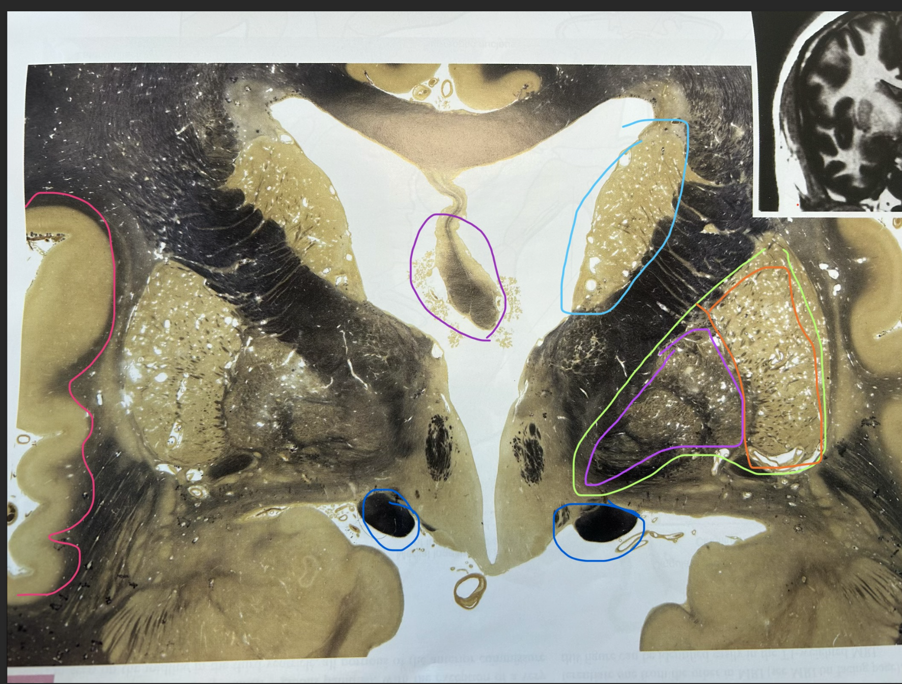 <p>whats in green </p>