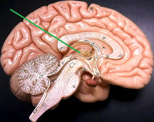 <p>the brains sensory switchboard, located on top of the brainstem; it directs messages to the sensory receiving areas in teh cortex and transmits replies to the cerebellum and medulla</p>