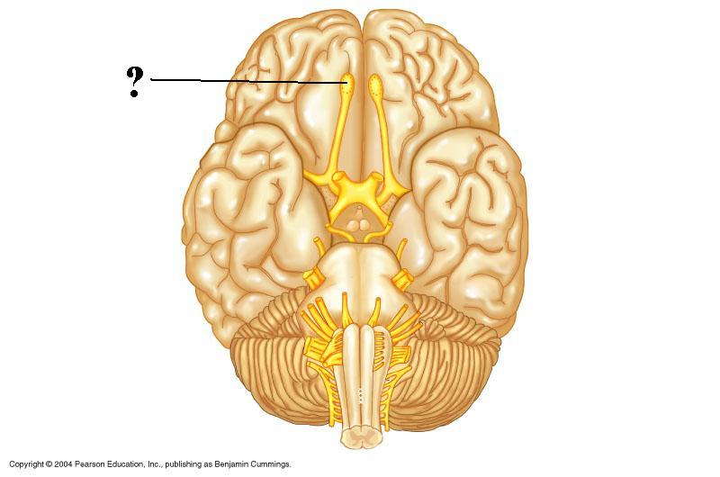 <p>Identify the indicated structure</p>
