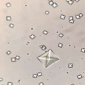 <ul><li><p>dihydrate looks like envelope with X on it. Acidic to neutral urine</p></li></ul><p></p><ul><li><p>Monohydrate is bad looks like a dumbbell or pointed at each end, indicates ethylene glycol poisoning </p></li></ul><p></p>