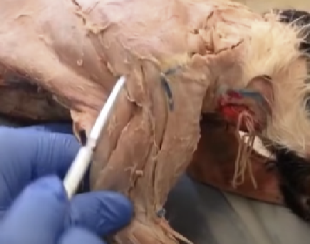 <p>Arises from the scapula spine and inserts on the proximal portion of the humerus. Flex the humerus and rotate it outward.</p>