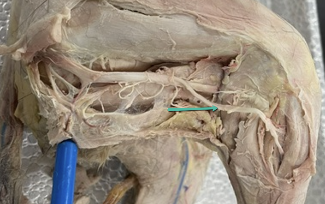 <p><span>Identify the nerve indicated by the pointer.</span></p>