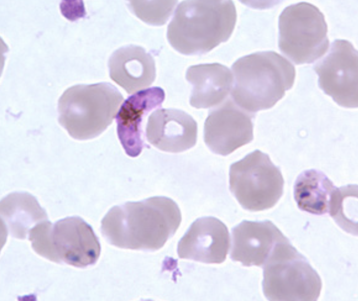 <p>What parasite is this?</p>