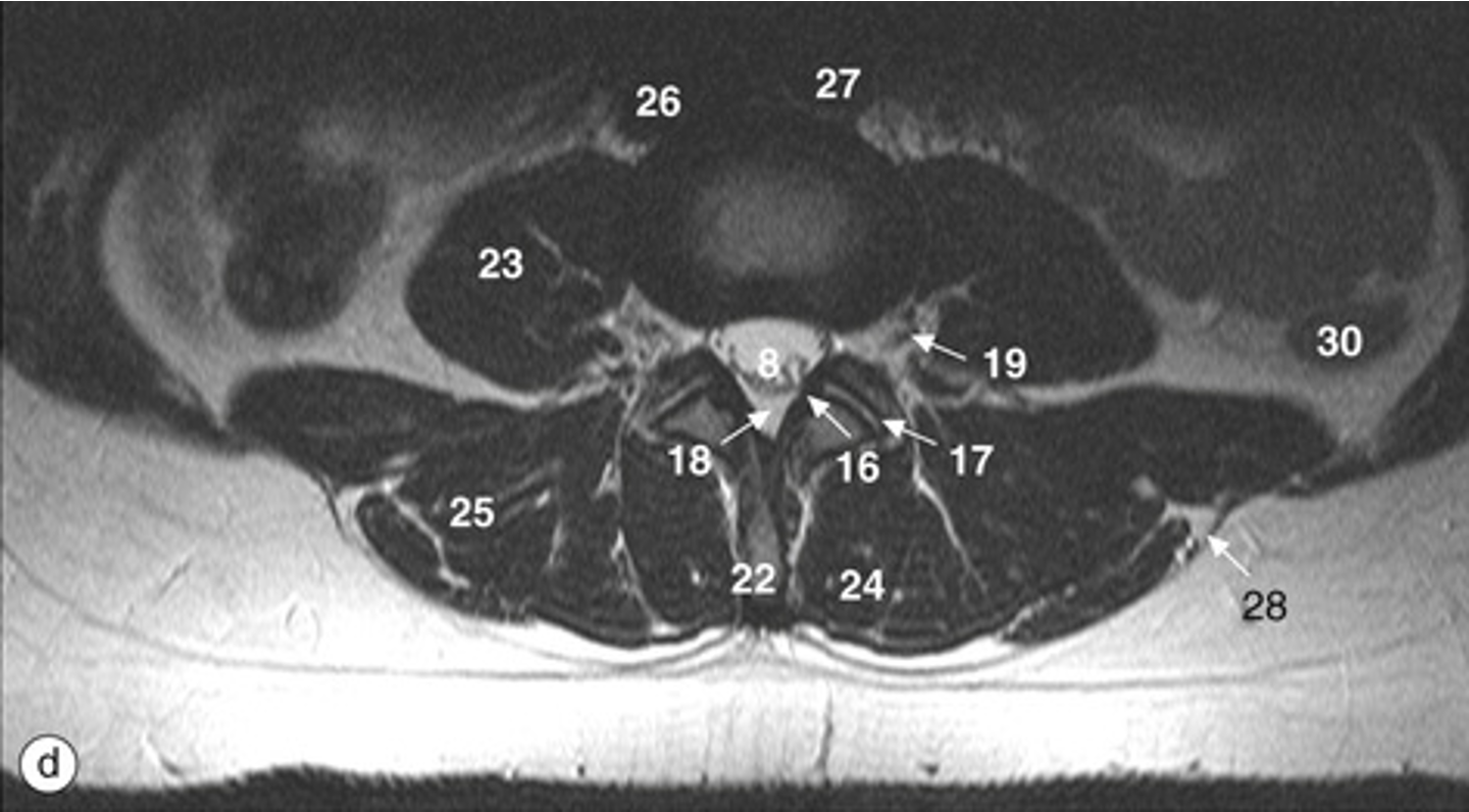 <p>18</p>