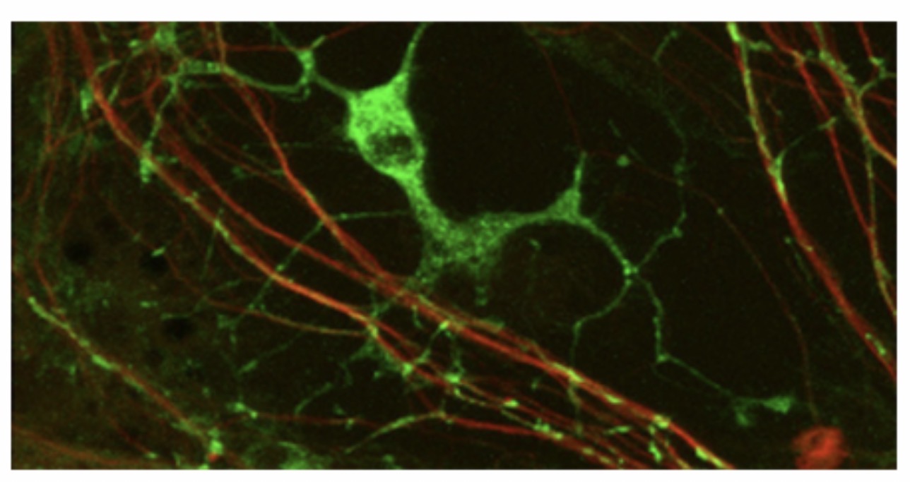 <p>Oligodendrocyte: Function: <span>Form myelin sheath in the CNS. Insulation of axons </span></p>