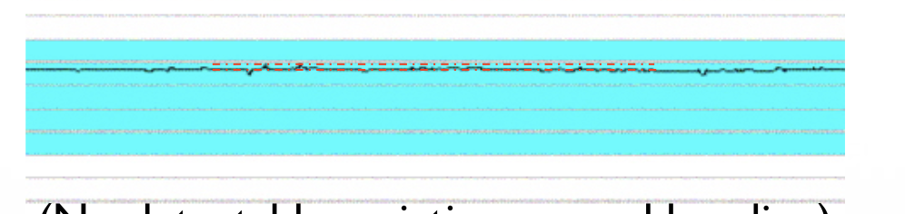 <p>this is what type of variability </p>