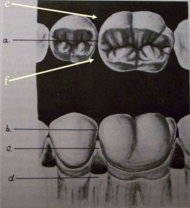 <p>What is indicated by Letter A? </p>