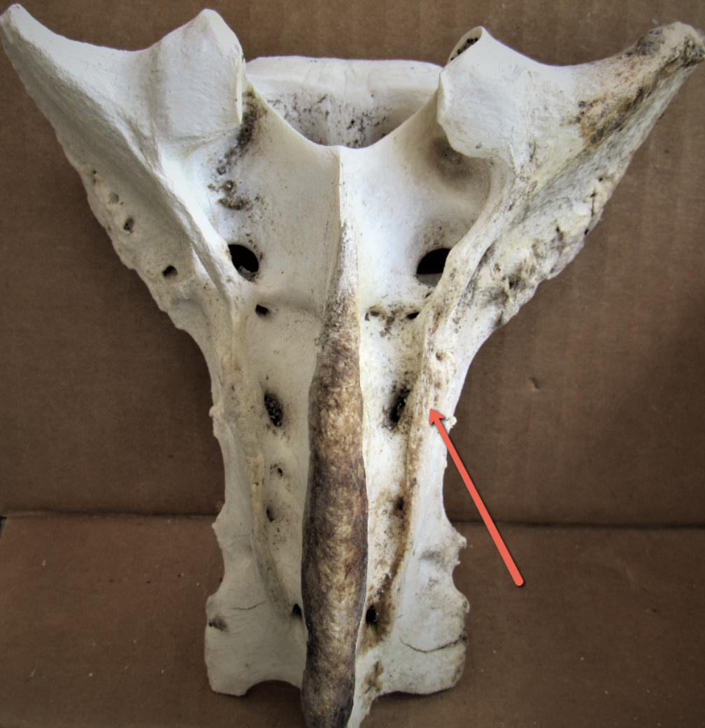 <p><strong>Identify the bone marking indicated by the pointer.</strong></p>