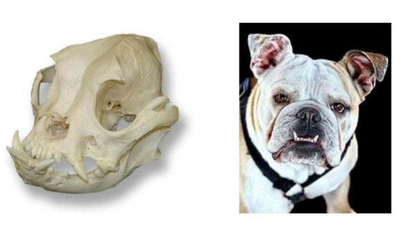 <p>Q: In cases of ……, the mandible is longer than the maxilla, which is commonly known as an "underbite". </p><p>A. Mandibular brachygnathism </p><p>B. Mandibular prognathism </p><p>C. Maxillary prognathism </p><p>D. Palatal dysplasia</p>