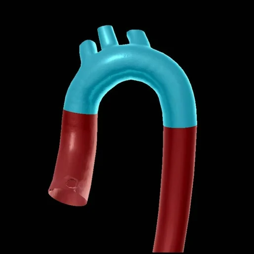 <p>a curved blood vessel from which arteries branch to the head and neck</p>