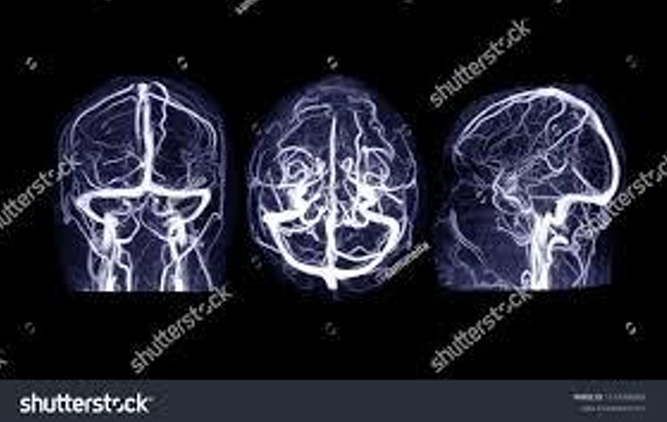 <p>type of imaging</p>